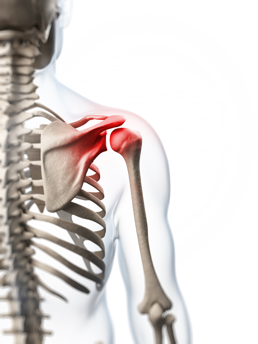 Laser Treatments for Rotator Cuff Injuries