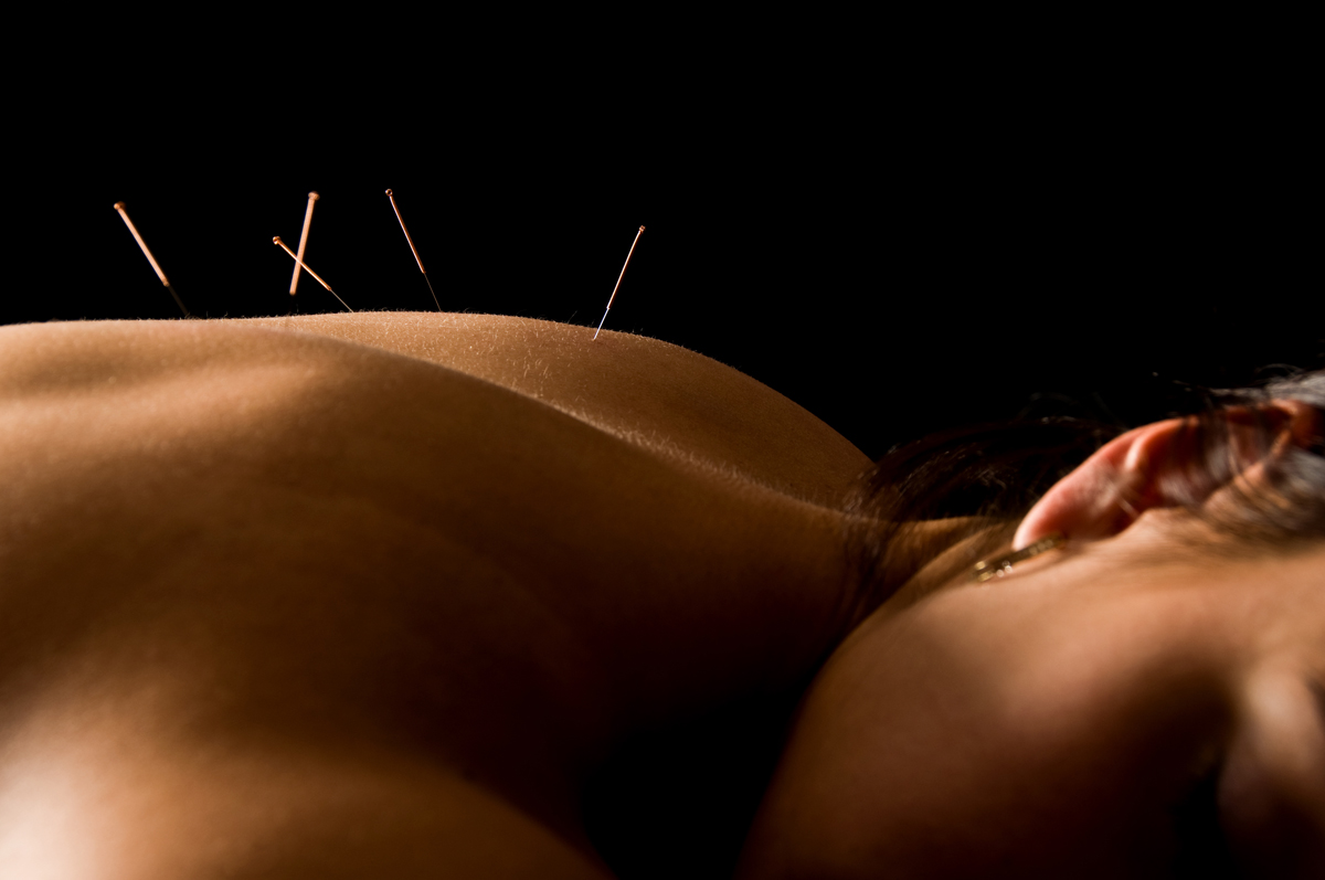 What can you expect after an Acupuncture treatment?